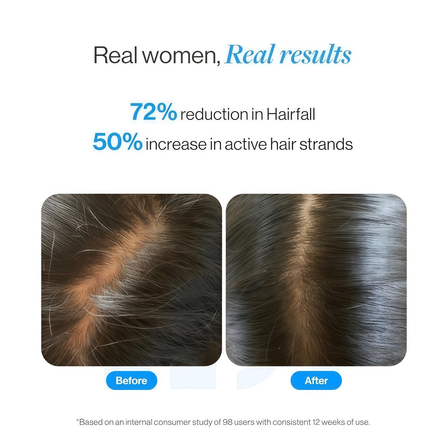 Advanced Hair Growth Serum